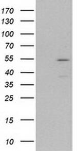 MEF2C Antibody in Western Blot (WB)