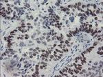 MEIS3 Antibody in Immunohistochemistry (Paraffin) (IHC (P))