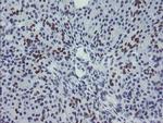 MEIS3 Antibody in Immunohistochemistry (Paraffin) (IHC (P))