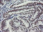 MEIS3 Antibody in Immunohistochemistry (Paraffin) (IHC (P))