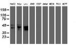 MEIS3 Antibody in Western Blot (WB)