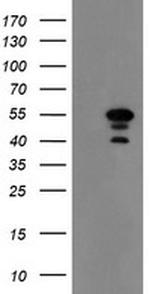 MEIS3 Antibody in Western Blot (WB)