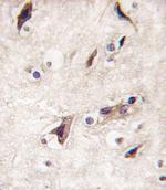 MERTK Antibody in Immunohistochemistry (IHC)