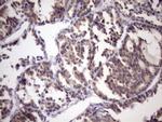 MGC12965 Antibody in Immunohistochemistry (Paraffin) (IHC (P))