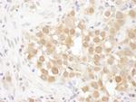 MGEA5 Antibody in Immunohistochemistry (IHC)