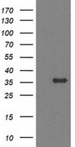 MGLL Antibody in Western Blot (WB)