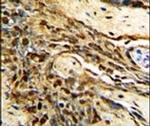 MGMT Antibody in Immunohistochemistry (IHC)