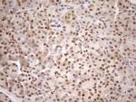 MGMT Antibody in Immunohistochemistry (Paraffin) (IHC (P))