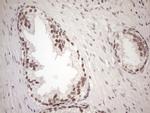 MGMT Antibody in Immunohistochemistry (Paraffin) (IHC (P))