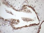 MGMT Antibody in Immunohistochemistry (Paraffin) (IHC (P))