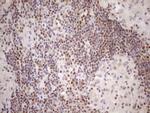 MGMT Antibody in Immunohistochemistry (Paraffin) (IHC (P))