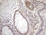 MGMT Antibody in Immunohistochemistry (Paraffin) (IHC (P))