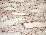 MGMT Antibody in Immunohistochemistry (Paraffin) (IHC (P))