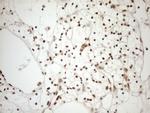 MGMT Antibody in Immunohistochemistry (Paraffin) (IHC (P))