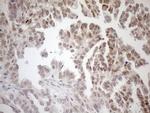 MGMT Antibody in Immunohistochemistry (Paraffin) (IHC (P))