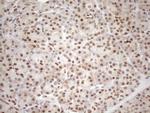 MGMT Antibody in Immunohistochemistry (Paraffin) (IHC (P))