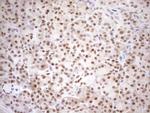 MGMT Antibody in Immunohistochemistry (Paraffin) (IHC (P))