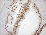 MGMT Antibody in Immunohistochemistry (Paraffin) (IHC (P))