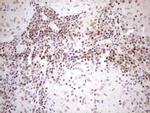 MGMT Antibody in Immunohistochemistry (Paraffin) (IHC (P))