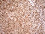 MGMT Antibody in Immunohistochemistry (Paraffin) (IHC (P))