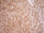 MGMT Antibody in Immunohistochemistry (Paraffin) (IHC (P))