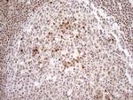 MGMT Antibody in Immunohistochemistry (Paraffin) (IHC (P))