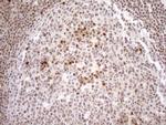 MGMT Antibody in Immunohistochemistry (Paraffin) (IHC (P))