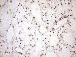 MGMT Antibody in Immunohistochemistry (Paraffin) (IHC (P))