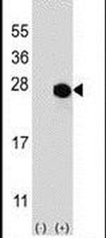 MGMT Antibody in Western Blot (WB)