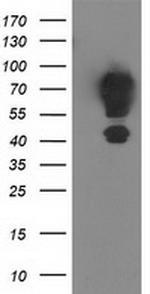 MGRN1 Antibody in Western Blot (WB)