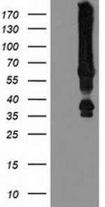 MGRN1 Antibody in Western Blot (WB)