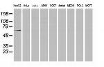 MGRN1 Antibody in Western Blot (WB)