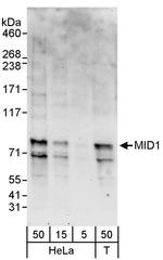 MID1 Antibody in Western Blot (WB)