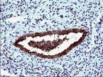 MLANA Antibody in Immunohistochemistry (Paraffin) (IHC (P))