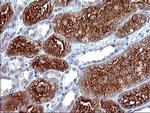 MLANA Antibody in Immunohistochemistry (Paraffin) (IHC (P))