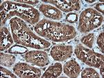 MLANA Antibody in Immunohistochemistry (Paraffin) (IHC (P))