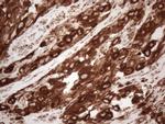 MLANA Antibody in Immunohistochemistry (Paraffin) (IHC (P))