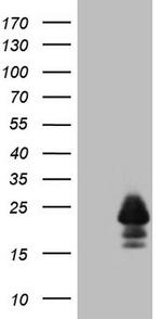 MLANA Antibody in Western Blot (WB)