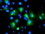 MLF1 Antibody in Immunocytochemistry (ICC/IF)