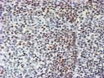 MLF1 Antibody in Immunohistochemistry (Paraffin) (IHC (P))