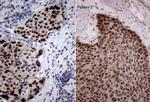 MLH1 Antibody in Immunohistochemistry (Paraffin) (IHC (P))