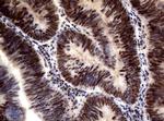 MLH1 Antibody in Immunohistochemistry (Paraffin) (IHC (P))