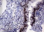 MLH1 Antibody in Immunohistochemistry (Paraffin) (IHC (P))