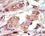 MLK2 Antibody in Immunohistochemistry (IHC)