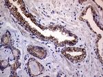 MLPH Antibody in Immunohistochemistry (Paraffin) (IHC (P))