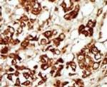 ZAK Antibody in Immunohistochemistry (IHC)