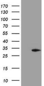 MMACHC Antibody in Western Blot (WB)