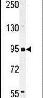 CD10 Antibody in Western Blot (WB)