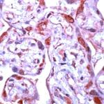 MMP1 Antibody in Immunohistochemistry (IHC)