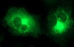 MMP13 Antibody in Immunocytochemistry (ICC/IF)